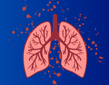 Ilustracja przedstawiająca schematyczne płuca w kolorze różowym z widoczną siecią oskrzeli, umieszczone na granatowym tle z czerwonymi plamkami wokół.